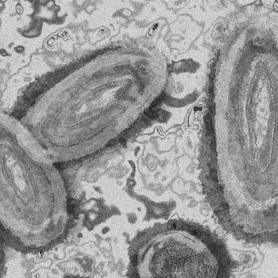 microscopic