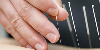 A UB student in the Acupuncture Institute